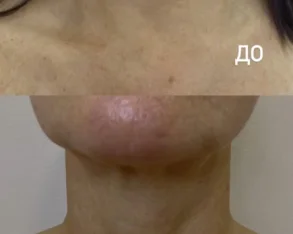 Студия косметологии и массажа Вау! Косметолог фото 2